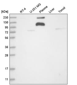 ADAMTS9 Antibody, Novus Biologicals 0.1mL; Unlabeled:Antibodies, Polyclonal